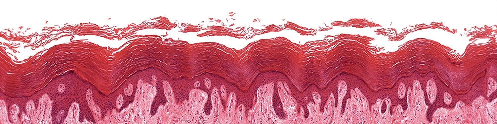 trz-blog-psoriasis-bilimi-1000x250